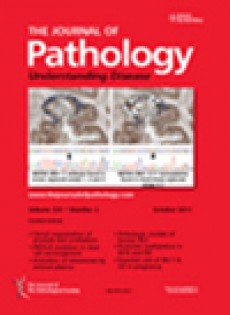 Journal Of Pathology